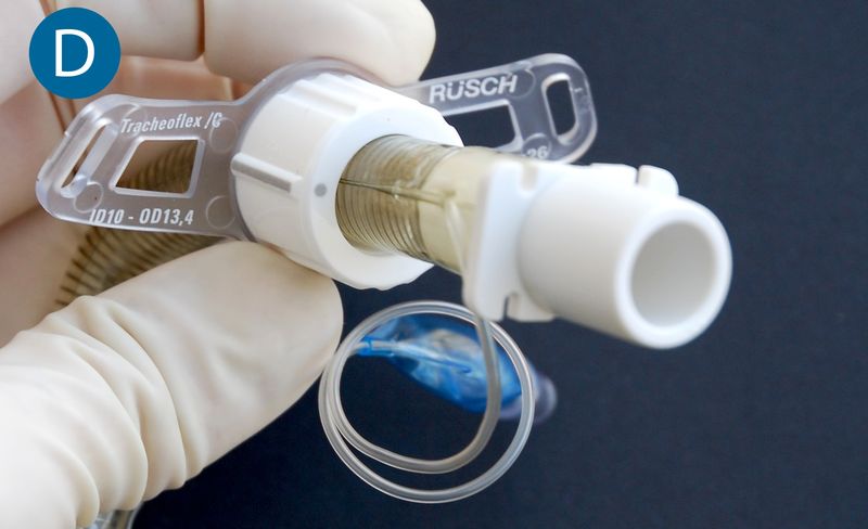 Stimmprothese Flexible Kan len